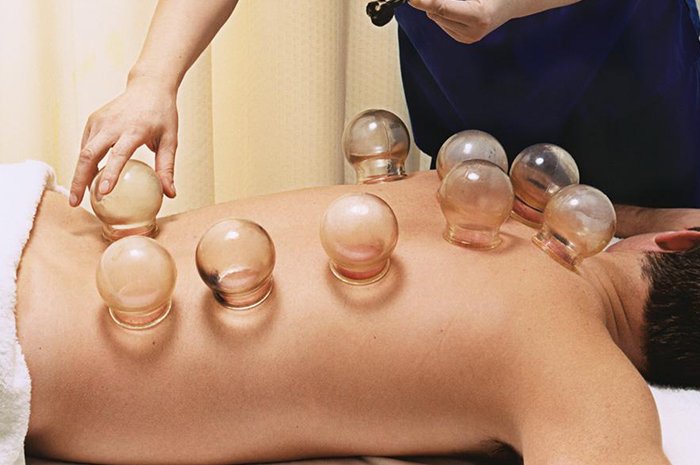 Cupping Massage
